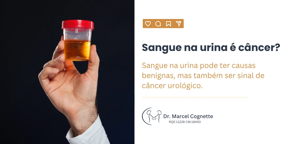 Sangue na urina