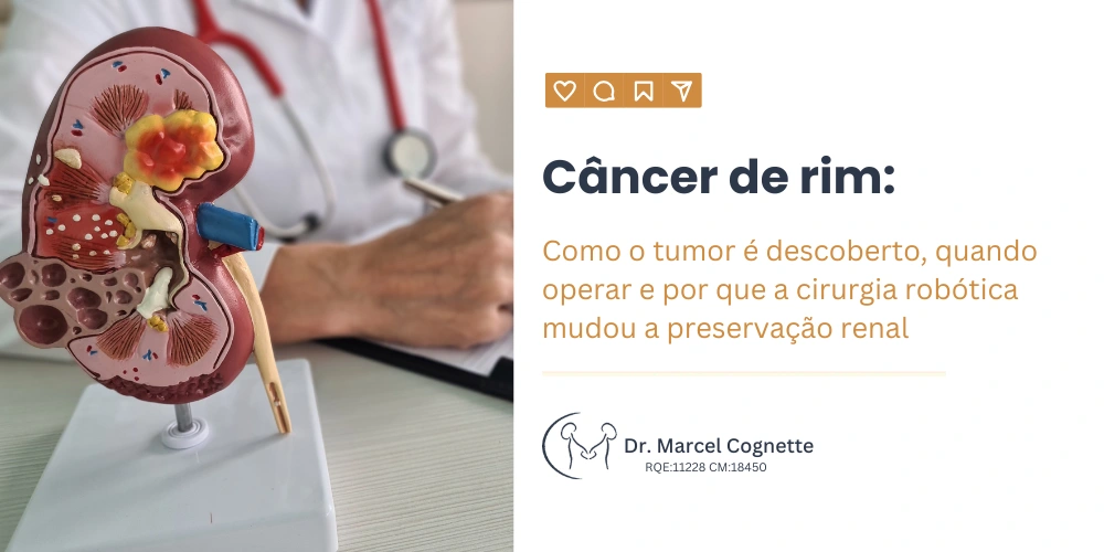 cancer de rim