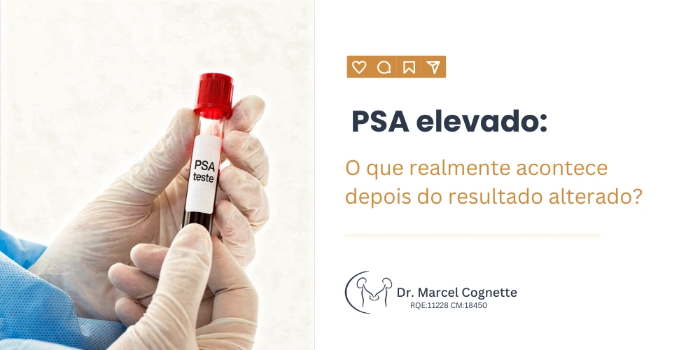 PSA elevado