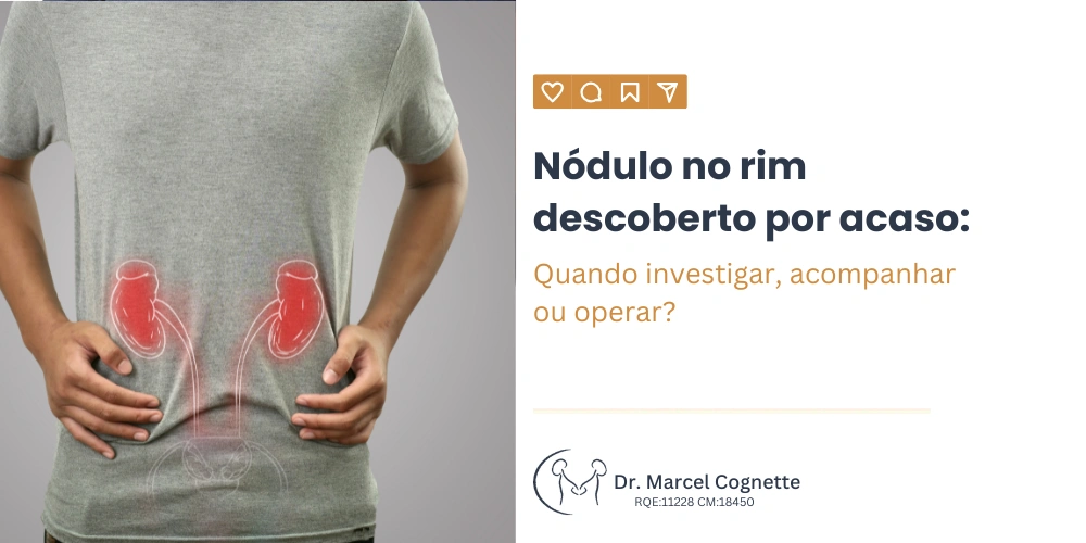 Nódulo no rim