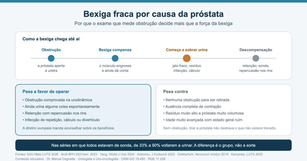 Infográfico sobre bexiga fraca causada pela próstata: linha do tempo da obstrução até a descompensação da bexiga e os fatores que pesam a favor e contra a cirurgia