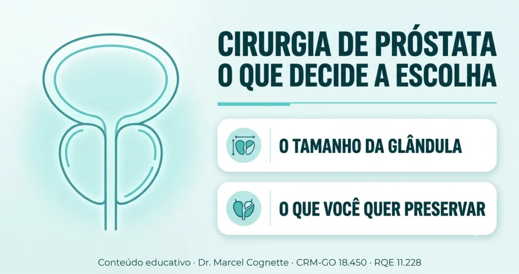 Ilustração de capa sobre cirurgia de próstata: o tamanho da glândula e o que o paciente quer preservar são os dois fatores que decidem a escolha da técnica